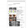 Dry Eye Analyzer (SL-6EB Slip Lamp) - Image 3